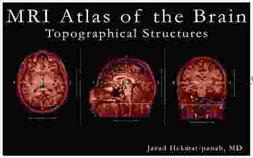 MRI Atlas of the Brain: Topographical Structures